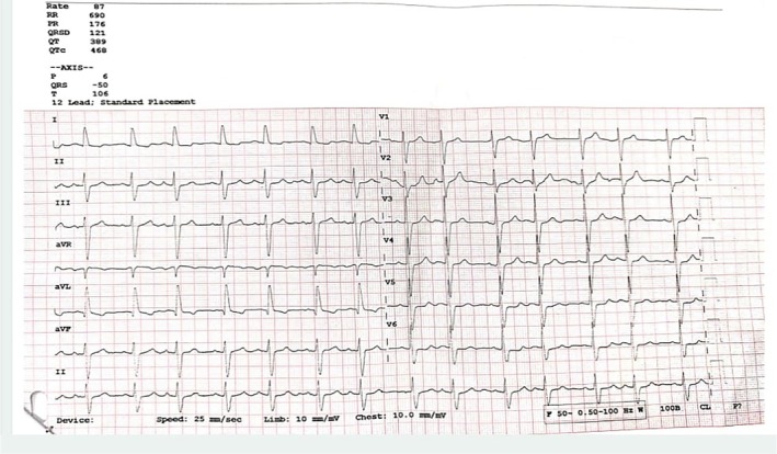 FIGURE 4