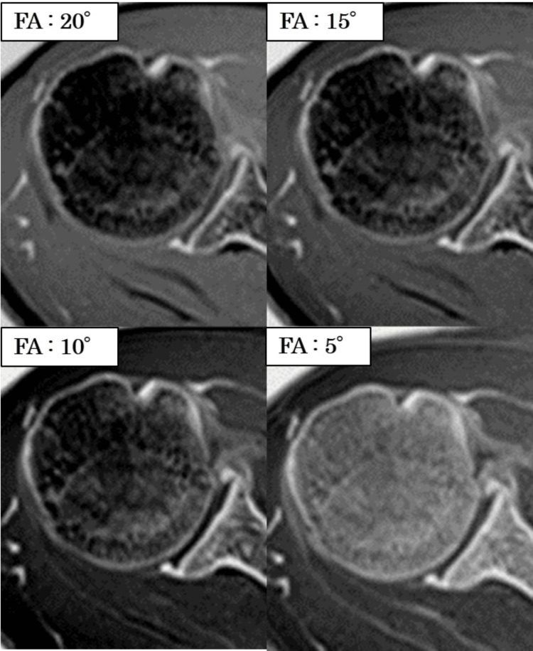 Figure 12