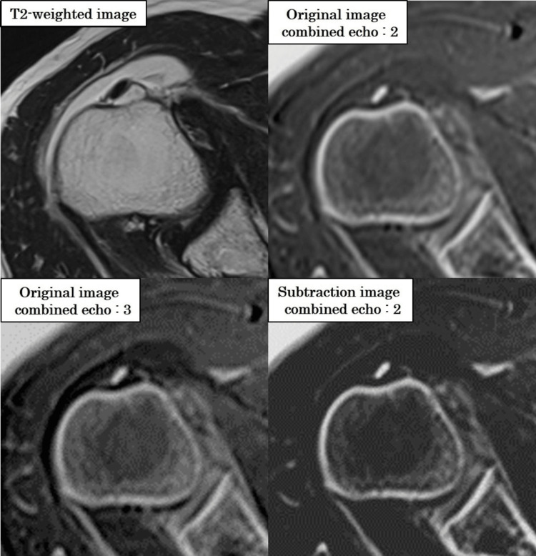 Figure 13