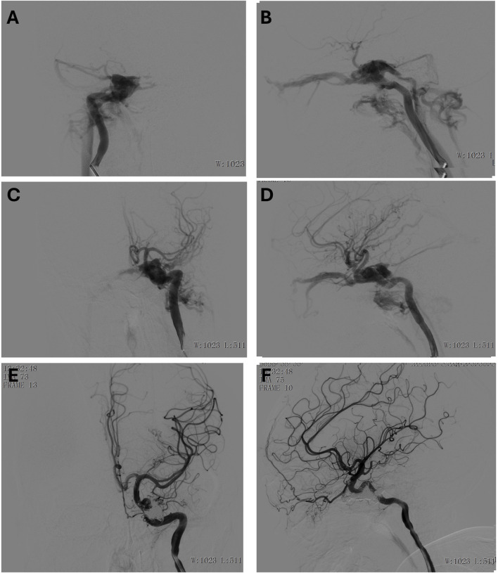 FIGURE 3