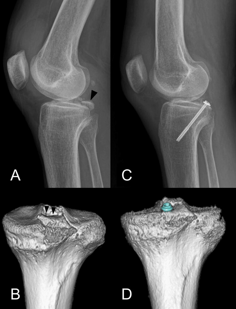 Figure 9