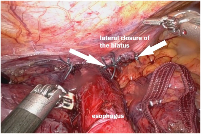 Figure 9