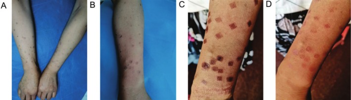 FIGURE 1