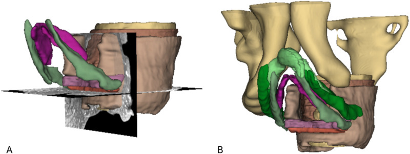 Fig 6