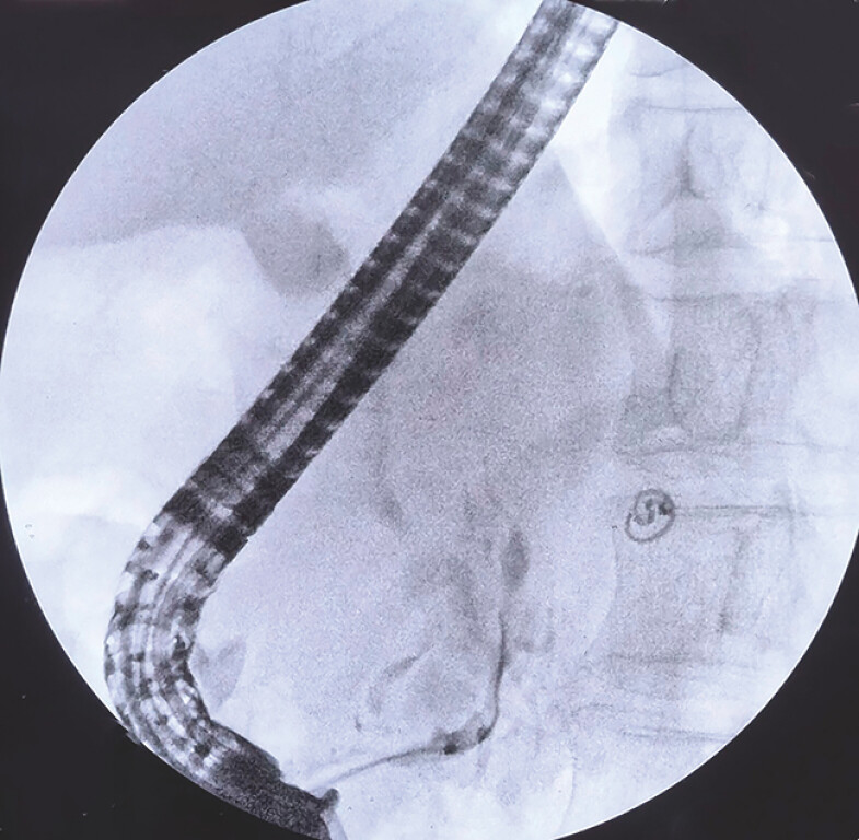 Fig. 1