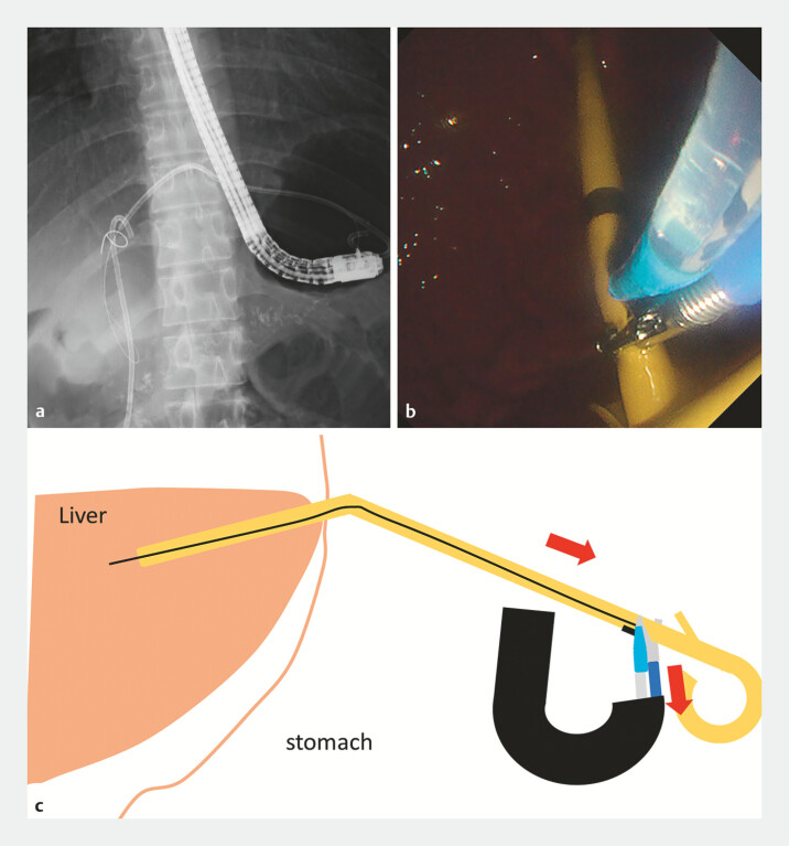 Fig. 4