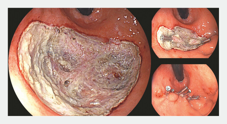Fig. 4