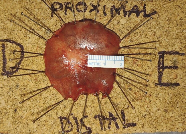 Fig. 4