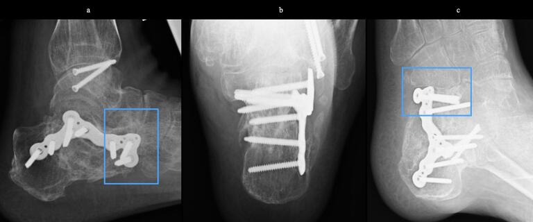Figure 10
