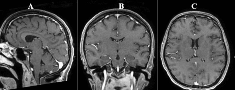 Figure 10