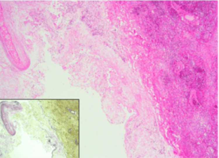 Figure 11