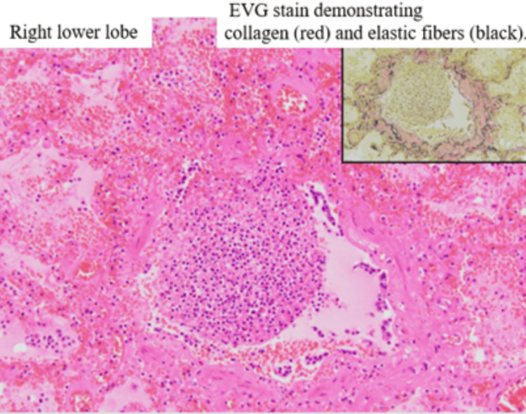 Figure 12
