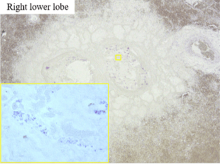 Figure 13