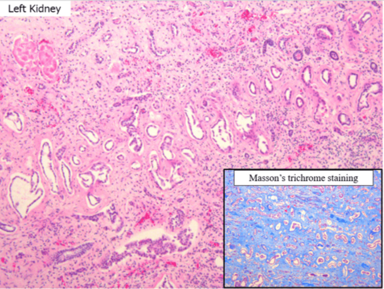 Figure 14