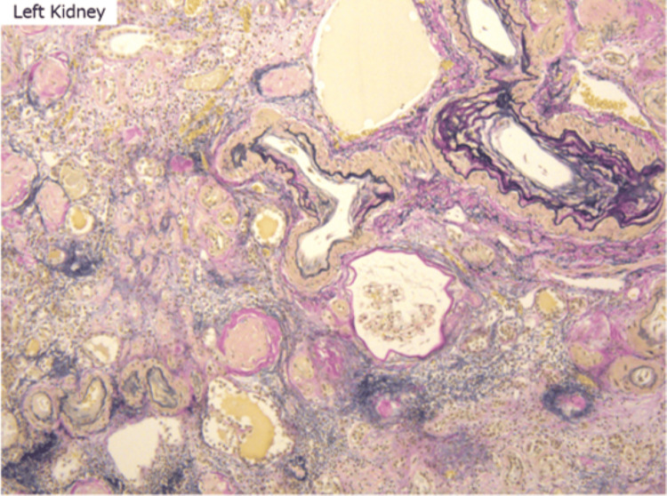 Figure 15