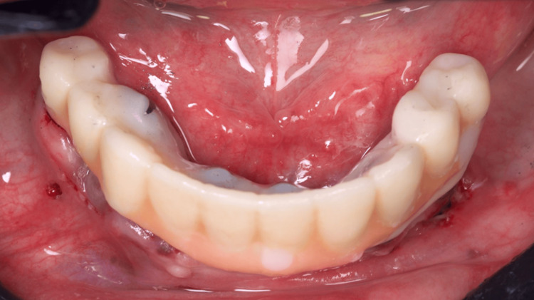 Figure 16