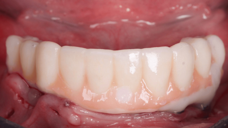 Figure 17