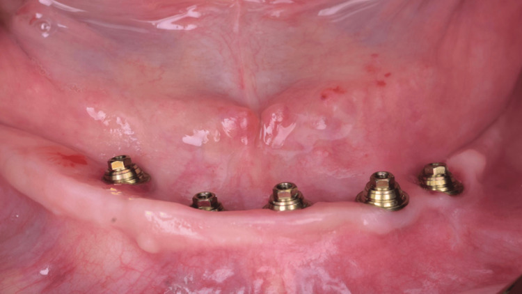 Figure 19
