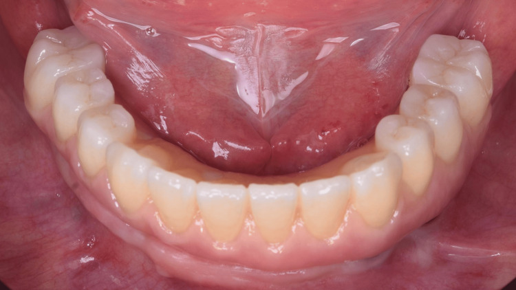 Figure 21