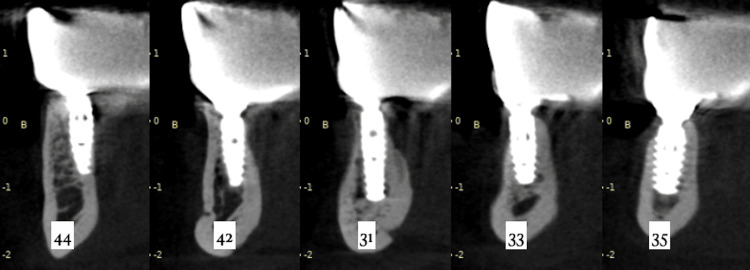Figure 22