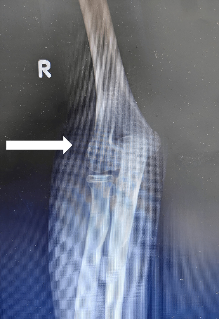 Figure 7