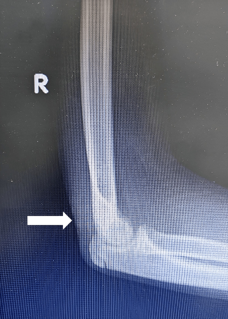 Figure 8