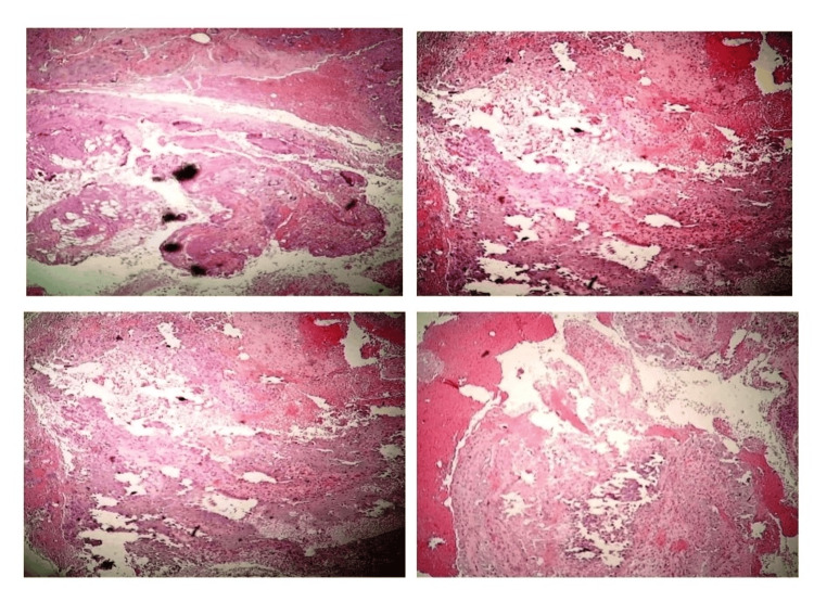 Figure 10