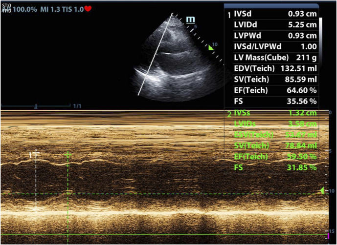 FIGURE 4