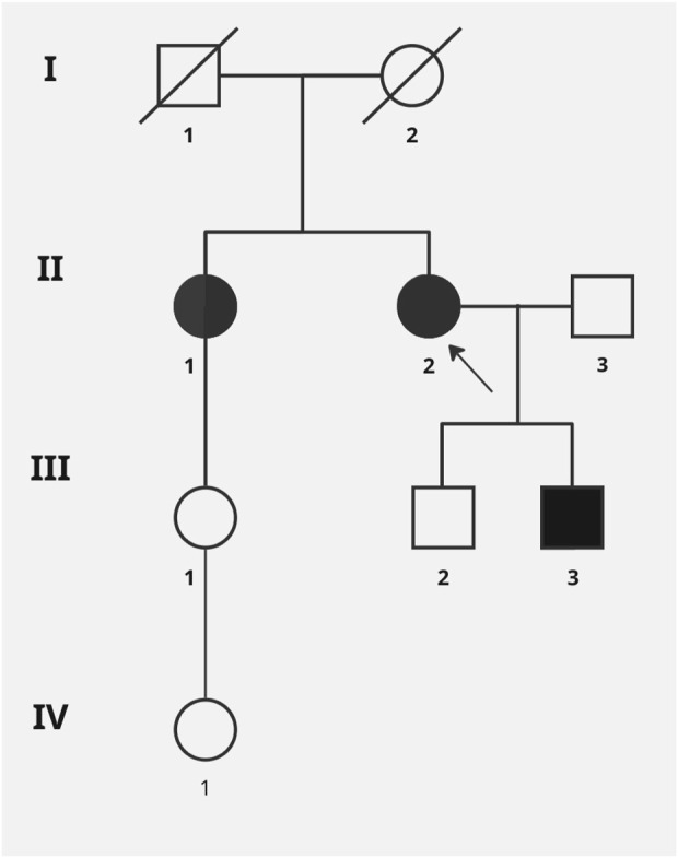 FIGURE 2
