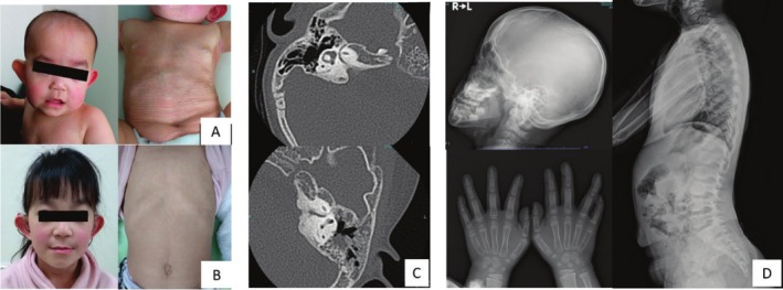 FIGURE 1
