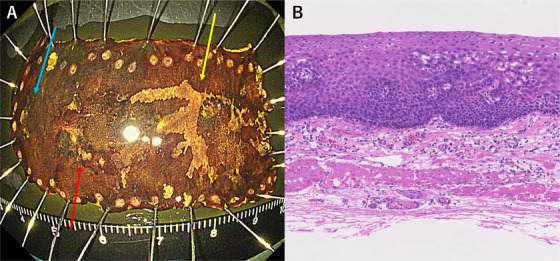 FIGURE 3