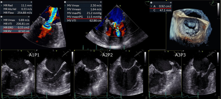 Figure 2