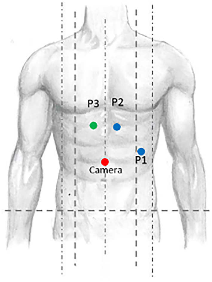 FIGURE 1