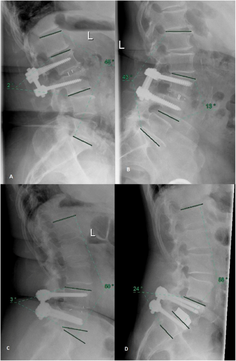 Figure 4