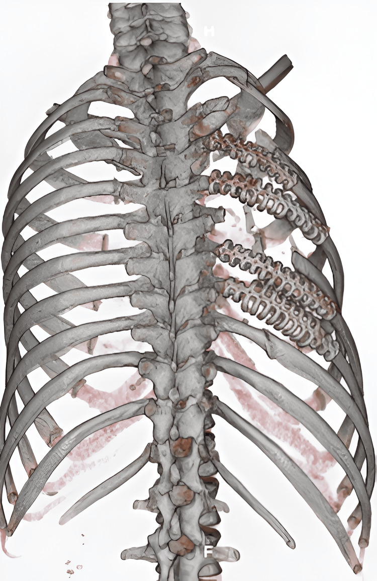 Figure 6