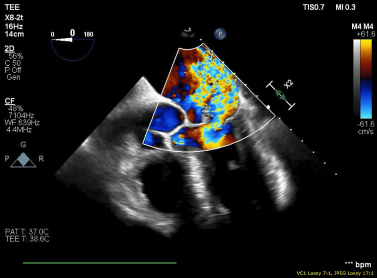 Figure 4
