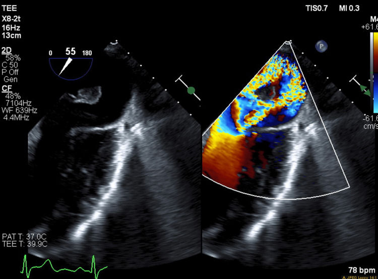 Figure 5
