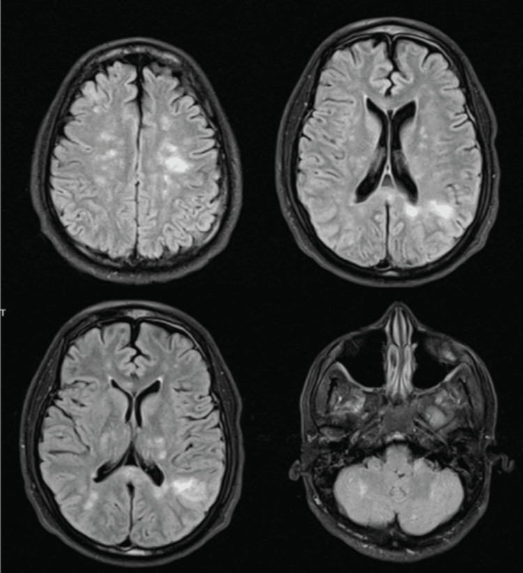 Figure 5