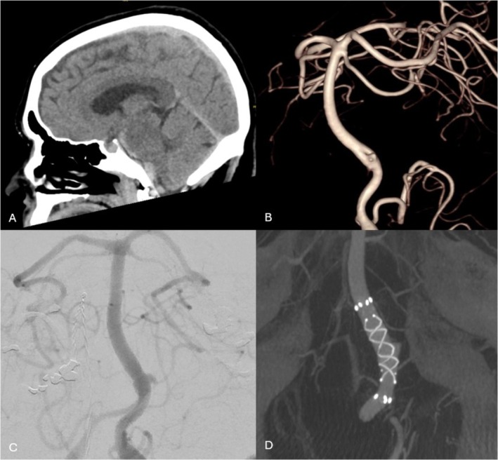 FIGURE 3