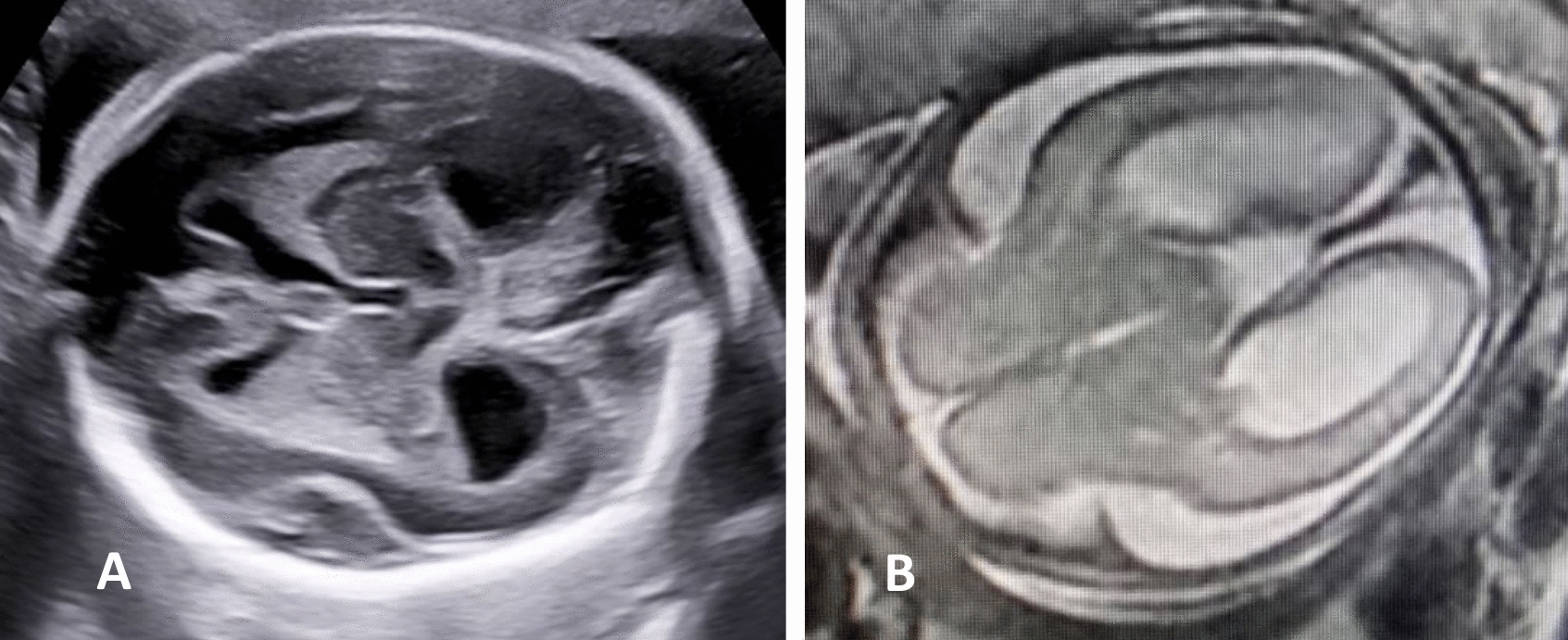 Figure 6