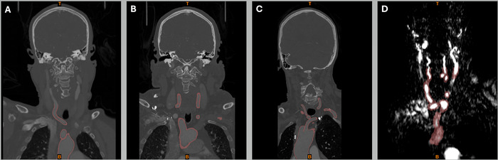 Figure 1