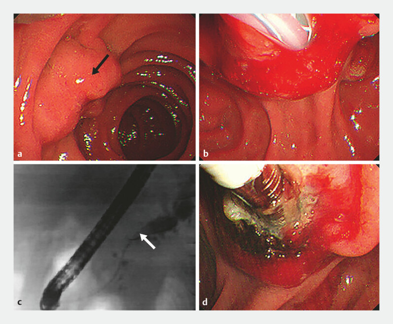 Fig. 4