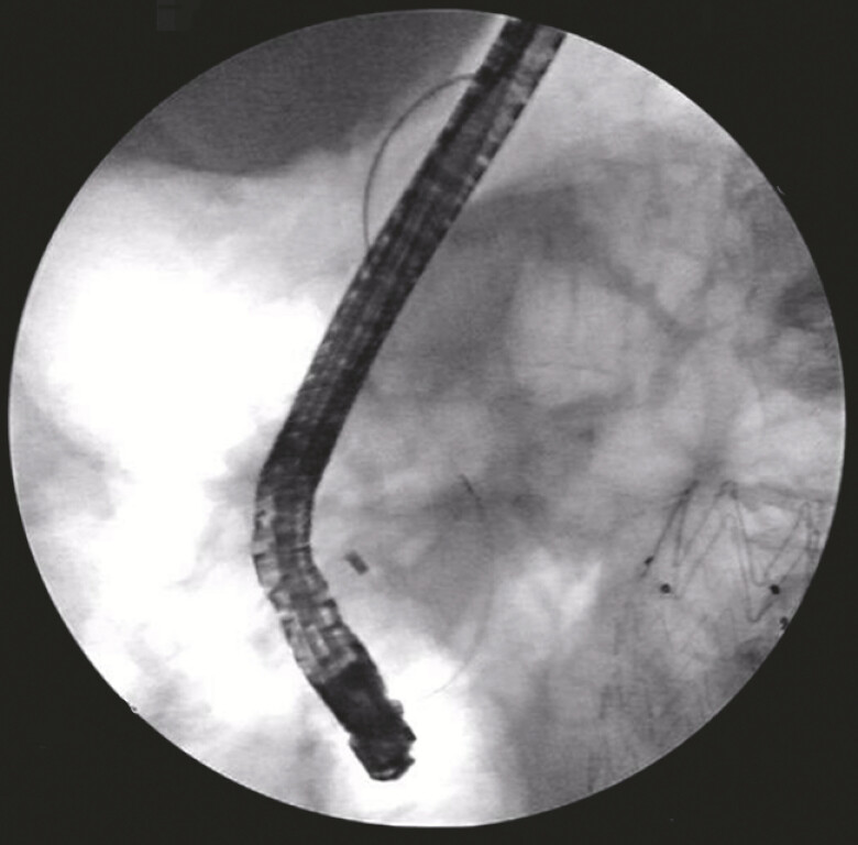Fig. 4
