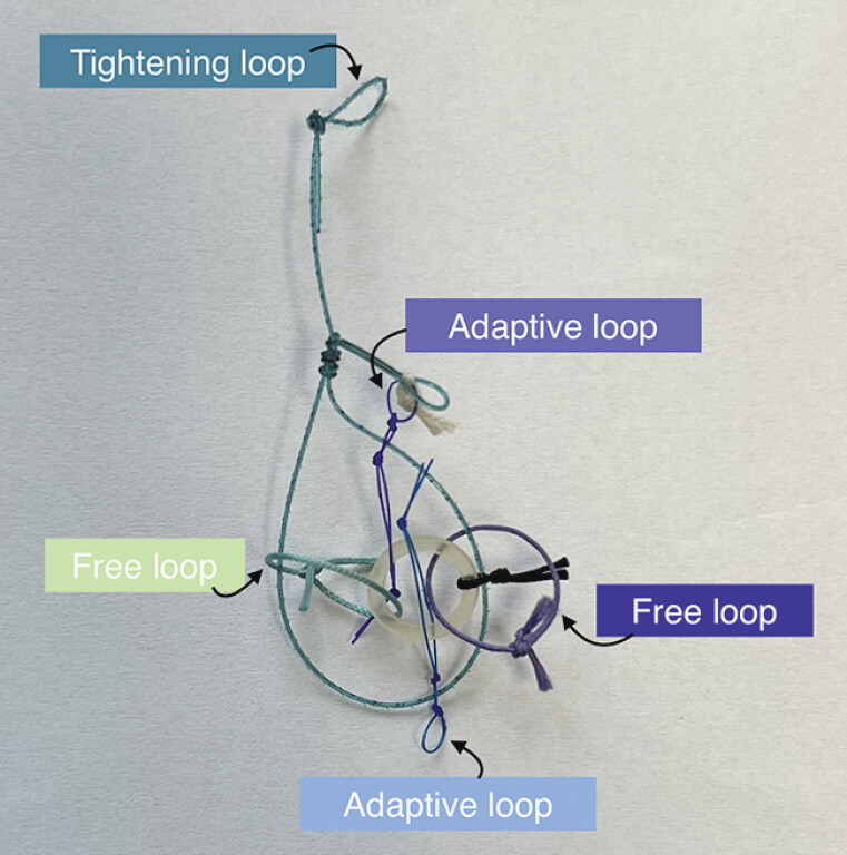 Fig. 2