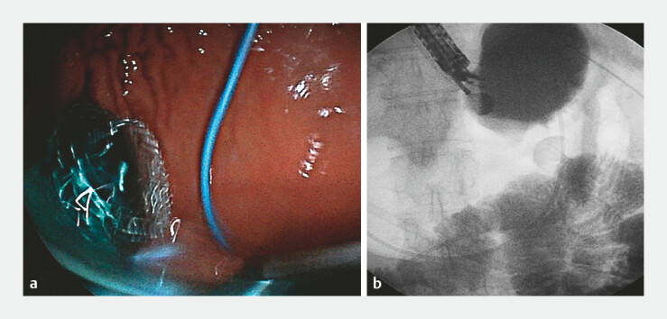 Fig. 4