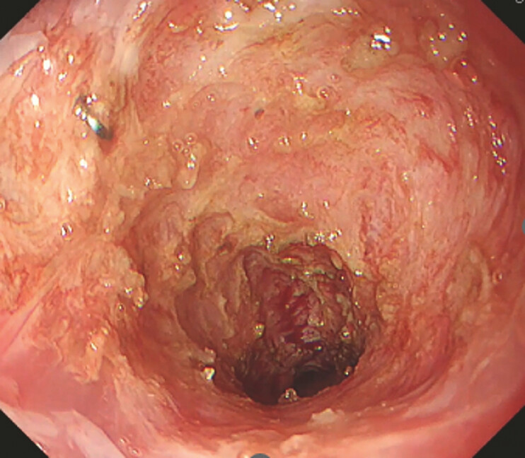 Fig. 4