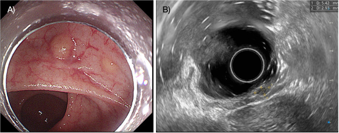 Figure 1