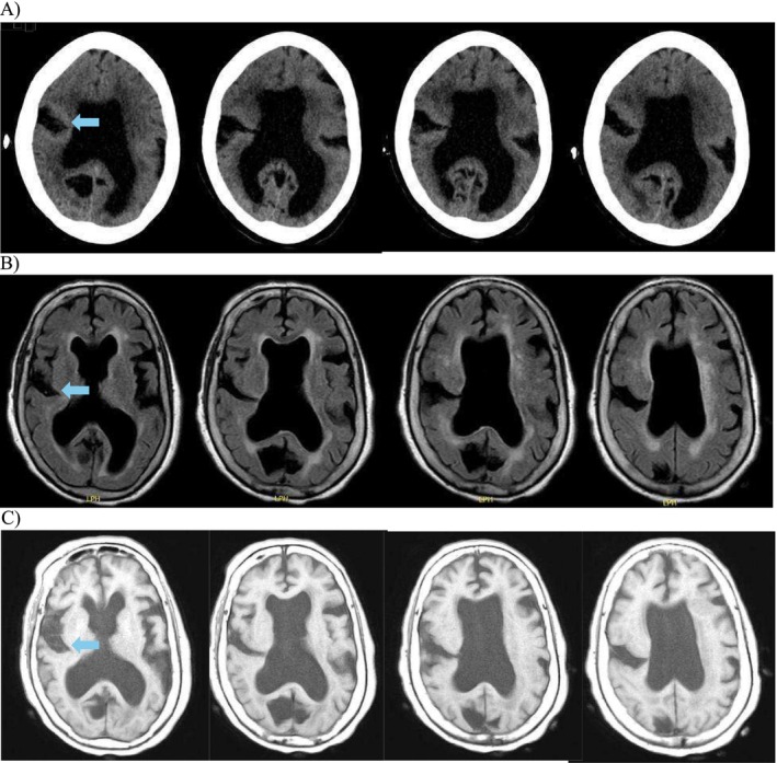 FIGURE 1