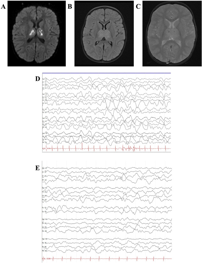 FIGURE 2