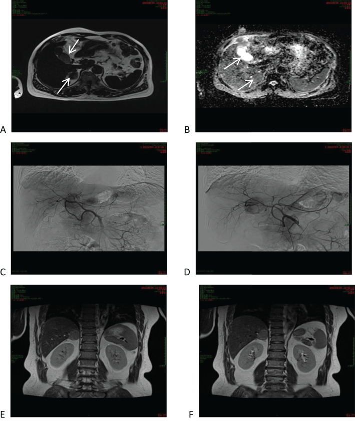 Figure 2